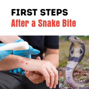What to Do Immediately After a Snake Bite