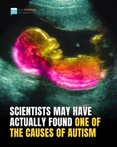 News & Current EventsStudy Suggests Key Link That Could Help Explain Autism Development