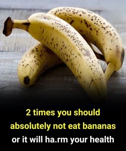 2 times you should absolutely not eat bananas
