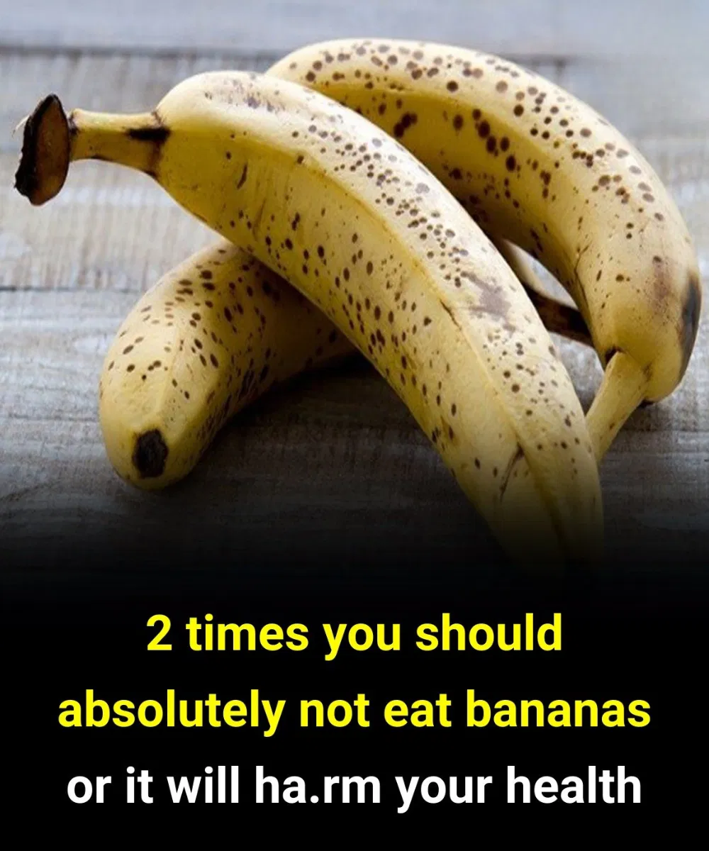 2 times you should absolutely not eat bananas