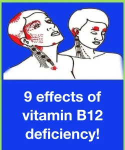 9 effects of vitamin B12 deficiency!