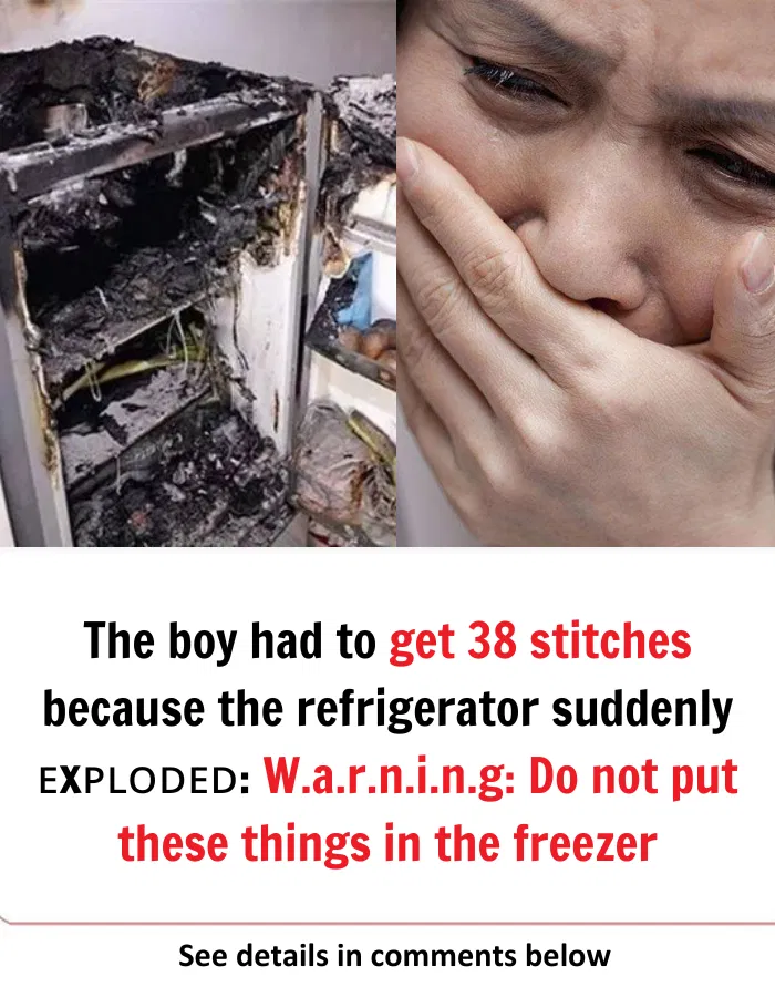 The boy had to get 38 stitches because the refrigerator suddenly ᴇxᴘʟᴏᴅᴇᴅ: W.a.r.n.i.n.g: Do not put these things in the freezer