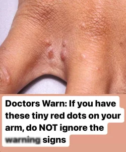 Don’t overlook these small red spots on your arm – They could be important wa:rning signs