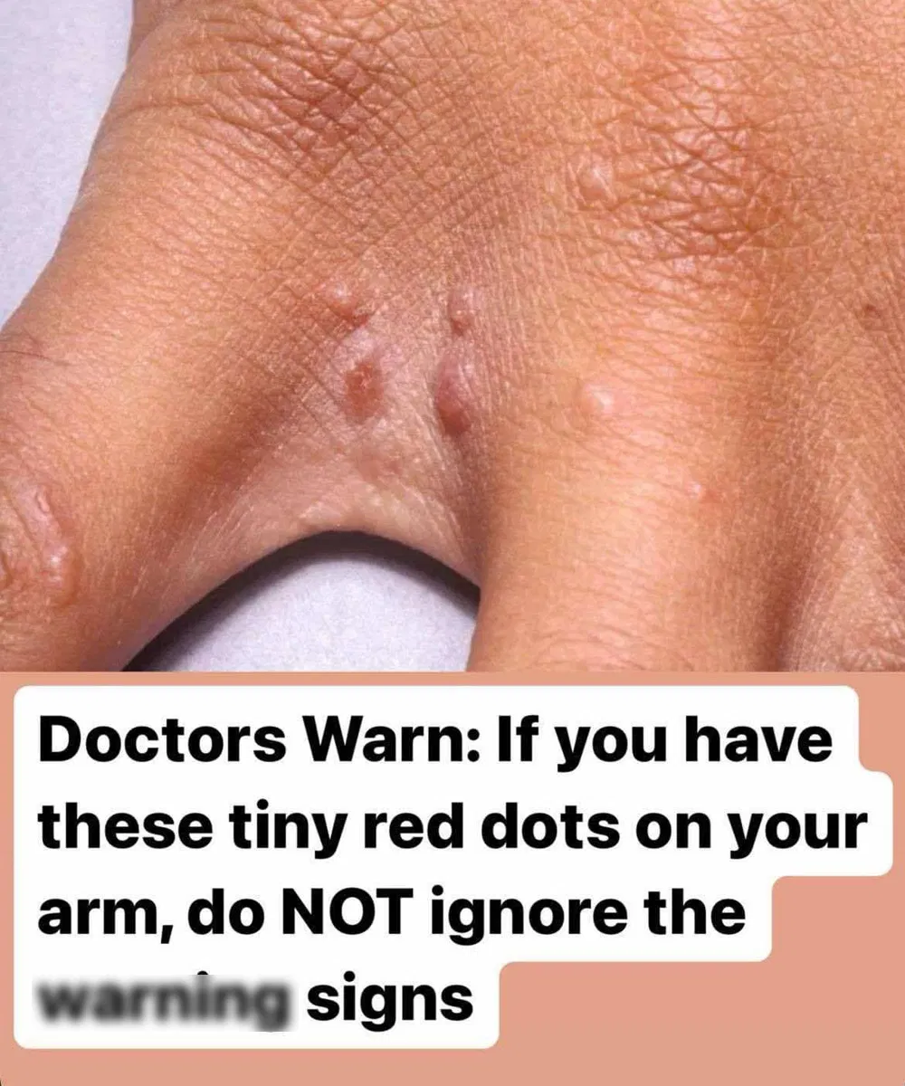 Don’t overlook these small red spots on your arm – They could be important wa:rning signs