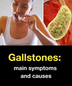 Gallstones: what they are, symptoms, causes and treatment