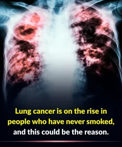 Lung cancer is on the rise in people who have never smoked, and this could be the reason