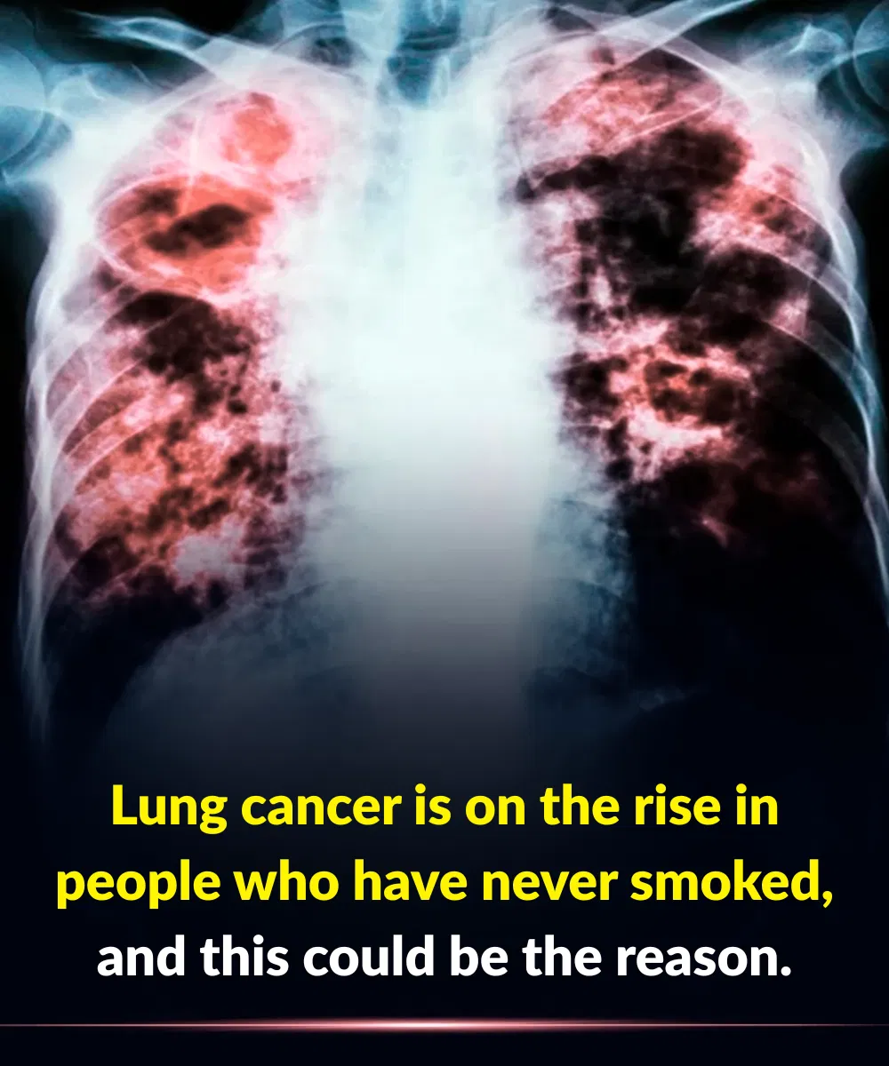 Lung cancer is on the rise in people who have never smoked, and this could be the reason
