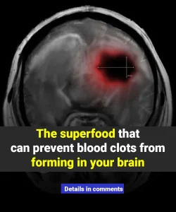 This superfood can prevent brain clots and protect your mental health