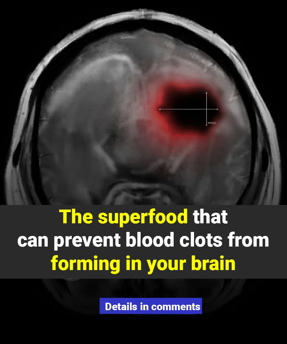 This superfood can prevent brain clots and protect your mental health