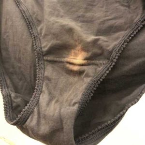 If You Find A “Bleach” Patch On Your Underwear, You’d Better Know What It Means