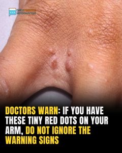 If You Have These Tiny Red Dots On Your Arm, Do Not Ignore The Warning Signs
