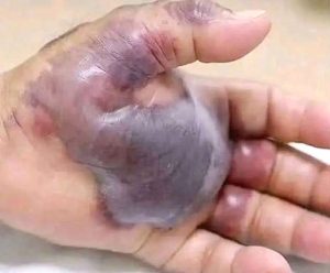 ATTENTION to these first signs of…