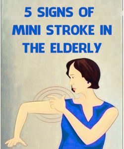 Mini Str0ke in the Elderly: Common and Unusual Symptoms