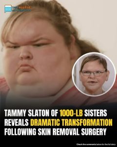 Tammy Slaton’s Stunning New Look After Surgery Has 1000-lb Sisters Fans In Awe