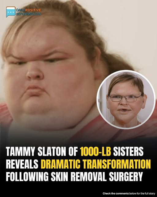 Tammy Slaton’s Stunning New Look After Surgery Has 1000-lb Sisters Fans In Awe