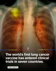 World-first lung cancer vaccine trials launched across seven countries