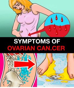 The Link Between Ovarian and Bre.ast Can.cer: What Every Woman Should Know