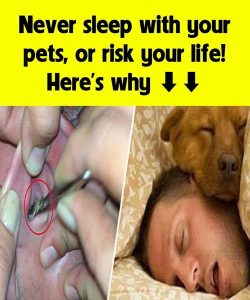 Don’t sleep with your pets, don’t risk your life, here’s why See 1st comment 👇