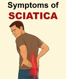 Sciatica and Spinal Stenosis: Understanding two overlooked yet disabling conditions