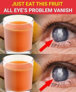 Better Vision? These 3 Natural Hacks & 8 Drinks to AVOID Glasses!