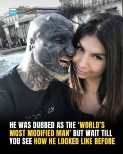 He Was Dubbed As The ‘World’s Most Modified Man’ But Wait Till You See How He Looked Like Before