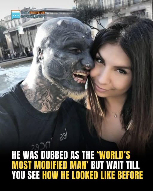 He Was Dubbed As The ‘World’s Most Modified Man’ But Wait Till You See How He Looked Like Before