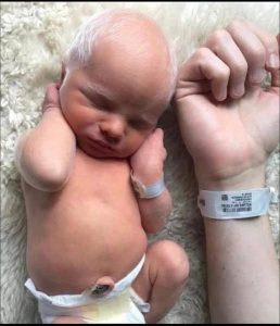 Albino baby mocked for white hair is happy and healthy years later