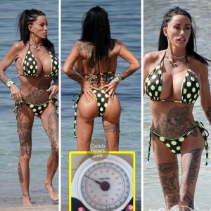 “Skin and Silicone”: Katie Price’s Alarming New Look Stuns Ibiza Beachgoers After Botched BBL and Shocking Weight Drop