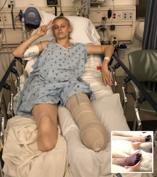 Woman Loses Her Legs Due To Common Household Product, Now She's Warning Women Everywhere