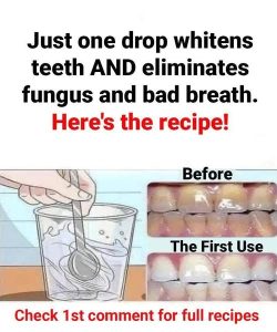 Just one drop whitens teeth, eliminates fungus, and fights bad breath
