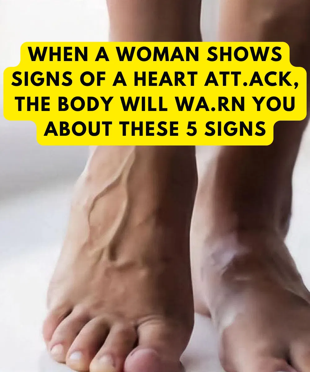 5 Symptoms in Women That Indicate a Heart Att.ack Is Coming