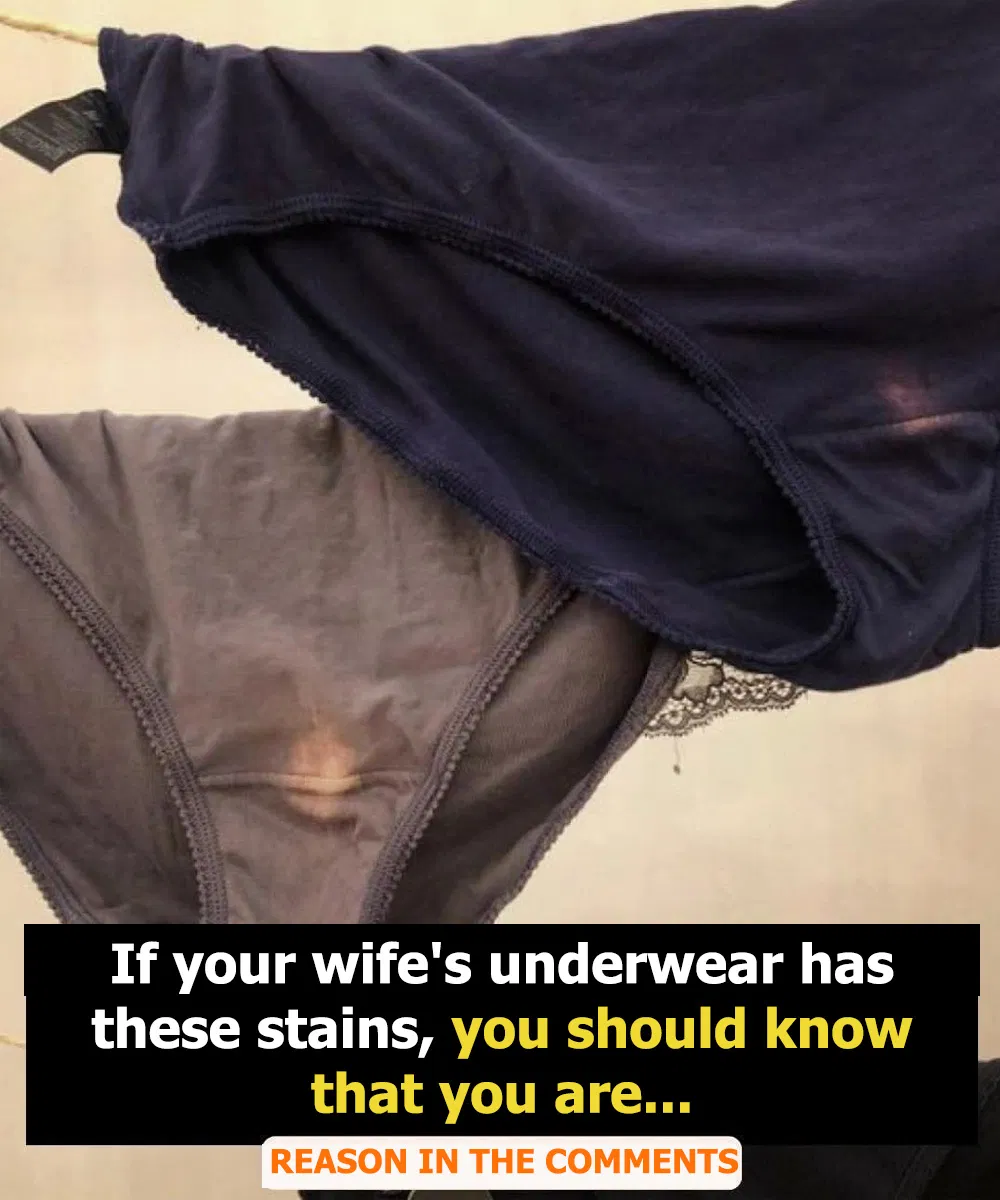Everything You Need to Know About The Fluid That Comes Out Of