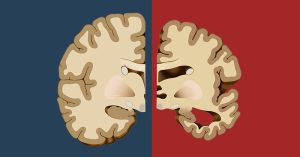 Before Dementia Sets in, Your Body Will Give You These 12 Early Warning Signs