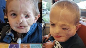 Boy, 5, survives savage attack by two dogs only to be called a ‘monster’ in public
