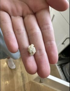 I sneezed 4-5 times yesterday and then felt something tickling my throat. Today, my throat is completely clear after this little thing came out.
