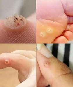 To BE VERY CAREFUL . If you get this, you are infected with …. Check the 1st comment