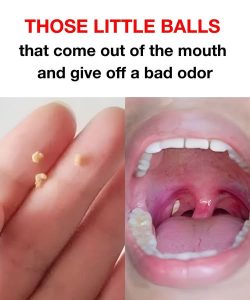 We explain exactly what it is and how to fix it