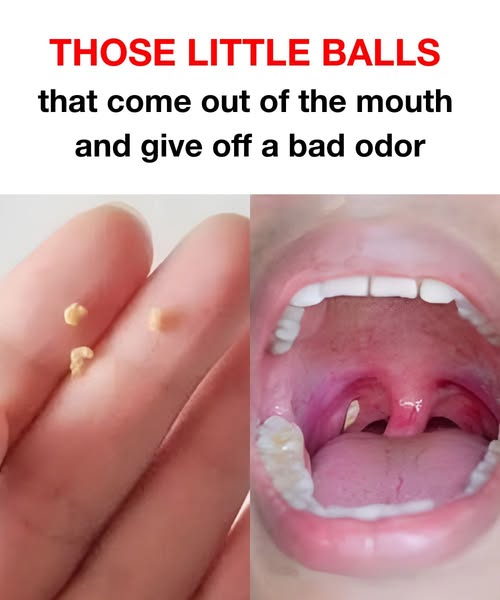 We explain exactly what it is and how to fix it