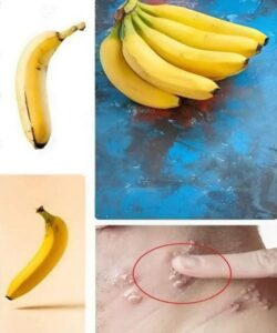 Did you know that if you eat BANANA EVERY DAY your body can…