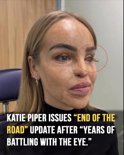 Katie Piper gives ‘end of the road’ update after eye health battles
