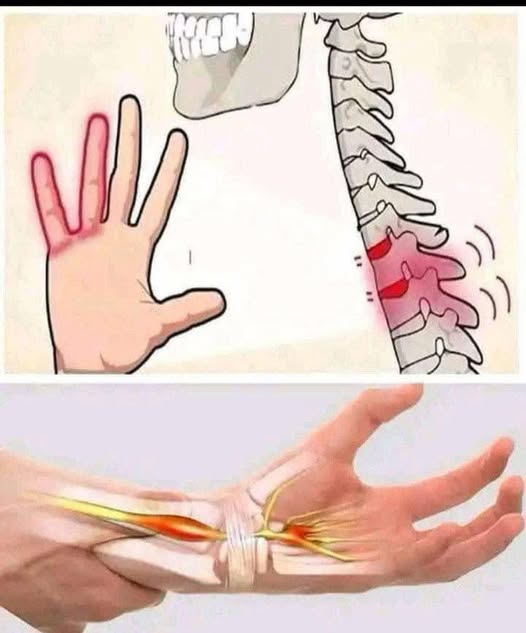 Why You Might Be Waking Up with Tingling Hands: Causes and Remedies