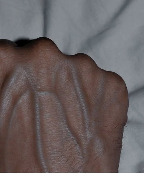 Visible Hand Veins and Why You Have Them