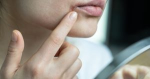 Nine ways to improve dry and flaky skin