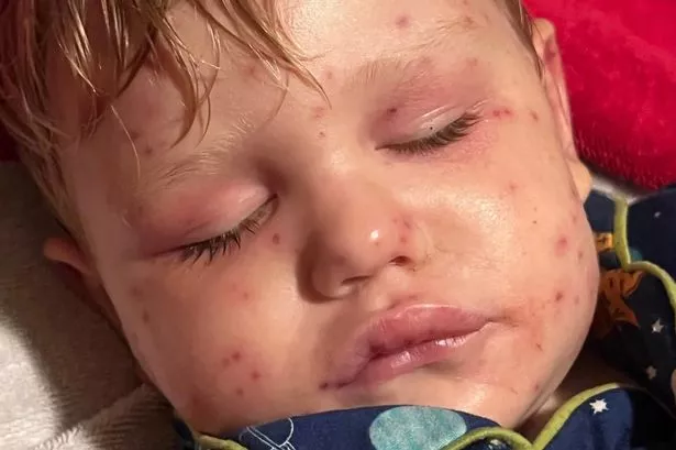 2-year-old Beckham Reed is clinging to life in a Georgia hospital after suffering over 150 yellowjacket stings, an attack that left the toddler unresponsive and requiring life support. According to family reports, Beckham was riding his electric toy car in the backyard when he unknowingly ran over a yellowjacket nest, triggering a vicious swarm that engulfed his small body within seconds.