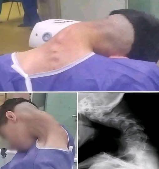 Fatal Cervical Spine Injury Highlights Rare and Catastrophic Workplace Accident