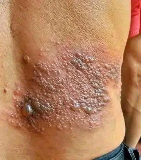 These are the consequences of sleeping with the…See more