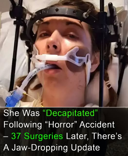 Woman survives being ‘decapitated’ after doctors reattach head