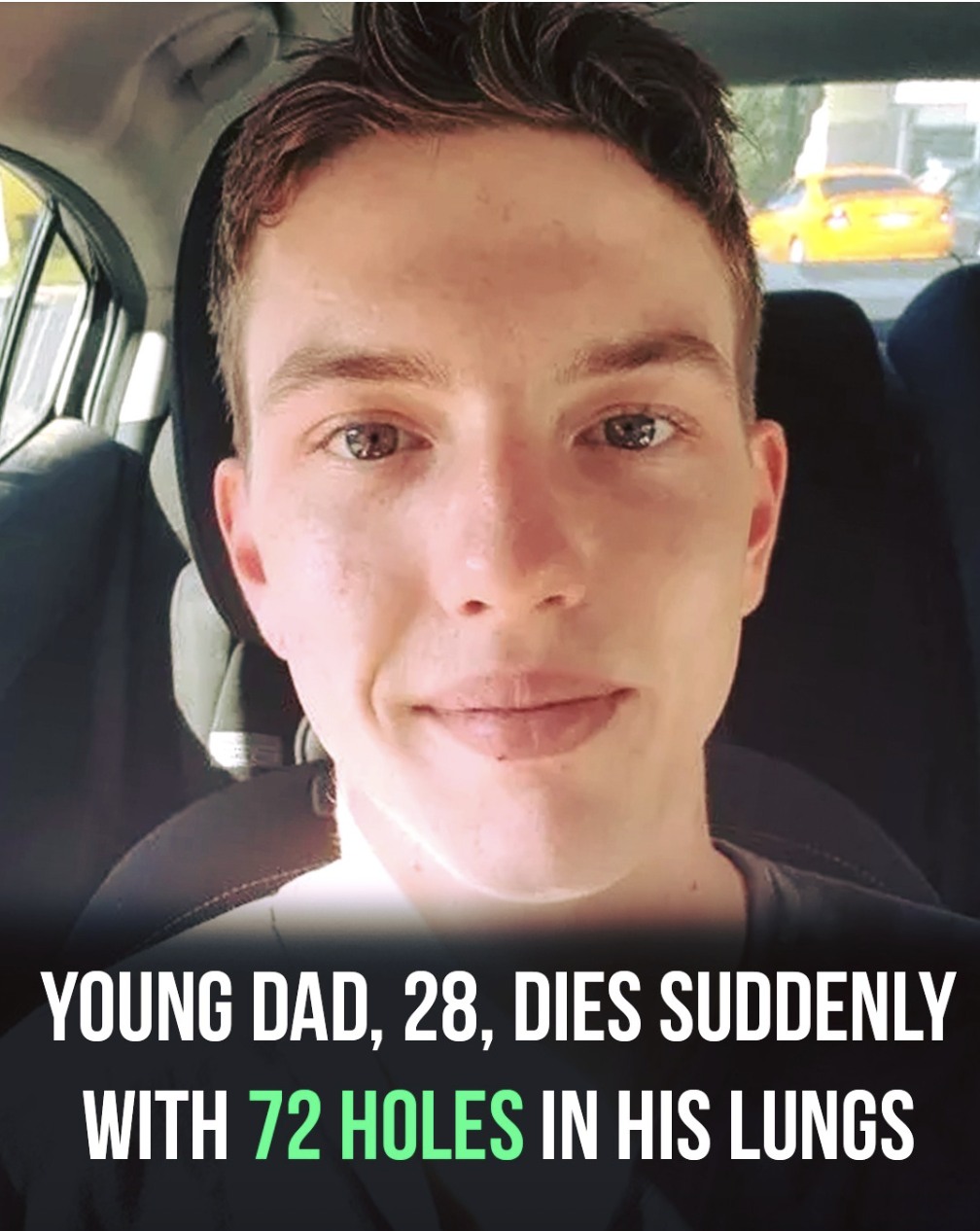 Young dad dies suddenly with 72 holes in his lungs