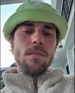 Justin Bieber admits that he tested positiv