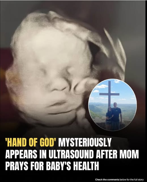 Mom spots ‘God’s hand’ cradling baby’s head in ultrasound
